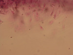 MISSING THUMBNAIL